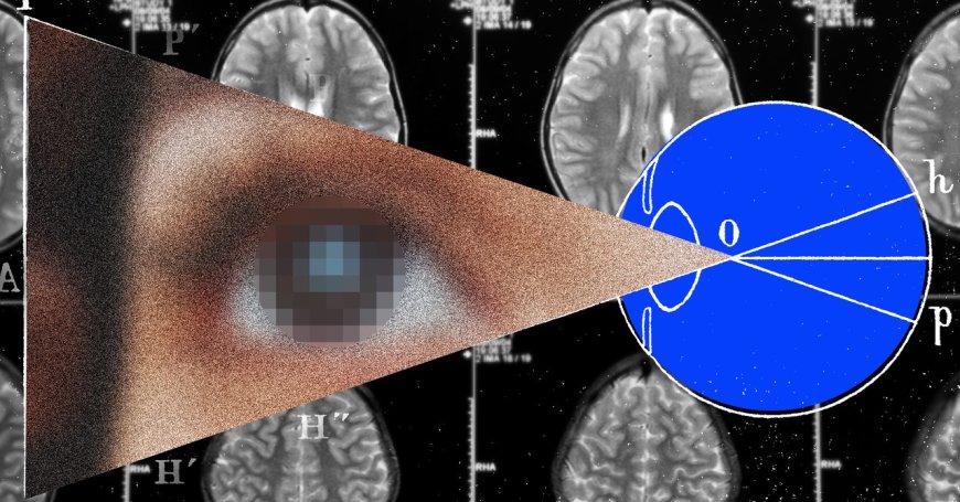 The Next Frontier for Brain Implants Is Artificial Vision